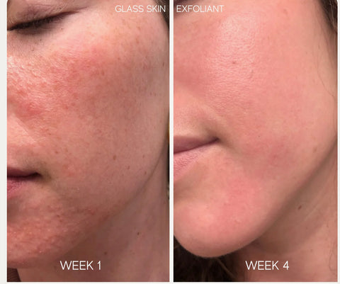 GLASS SKIN LIQUID EXFOLIANT